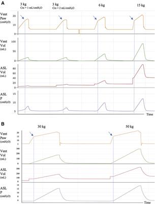 Airway opening pressure maneuver to detect airway closure in mechanically ventilated pediatric patients